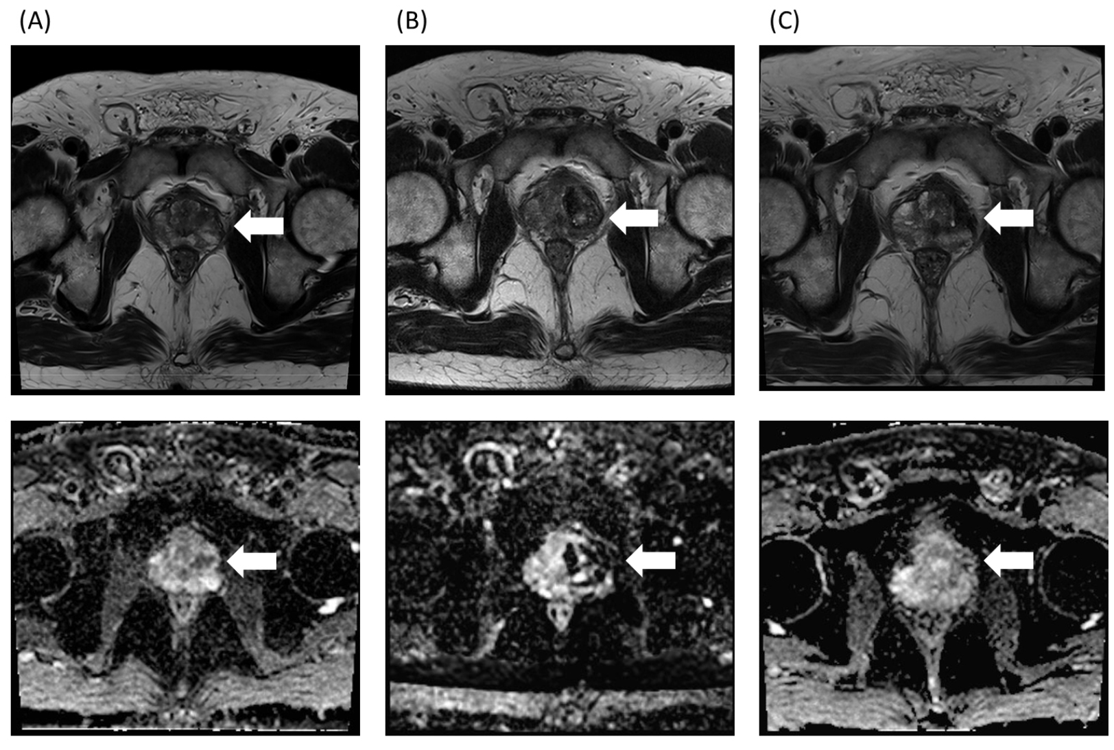 https://cdn.apub.kr/journalsite/sites/urology/2021-002-01/N0050020101/images/urology_02_01_01_F3.jpg
