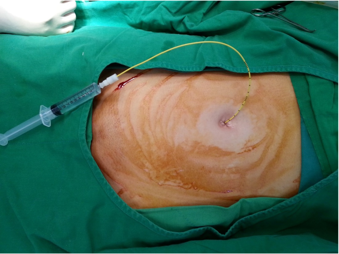 https://cdn.apub.kr/journalsite/sites/urology/2021-002-01/N0050020107/images/urology_02_01_07_F3.jpg