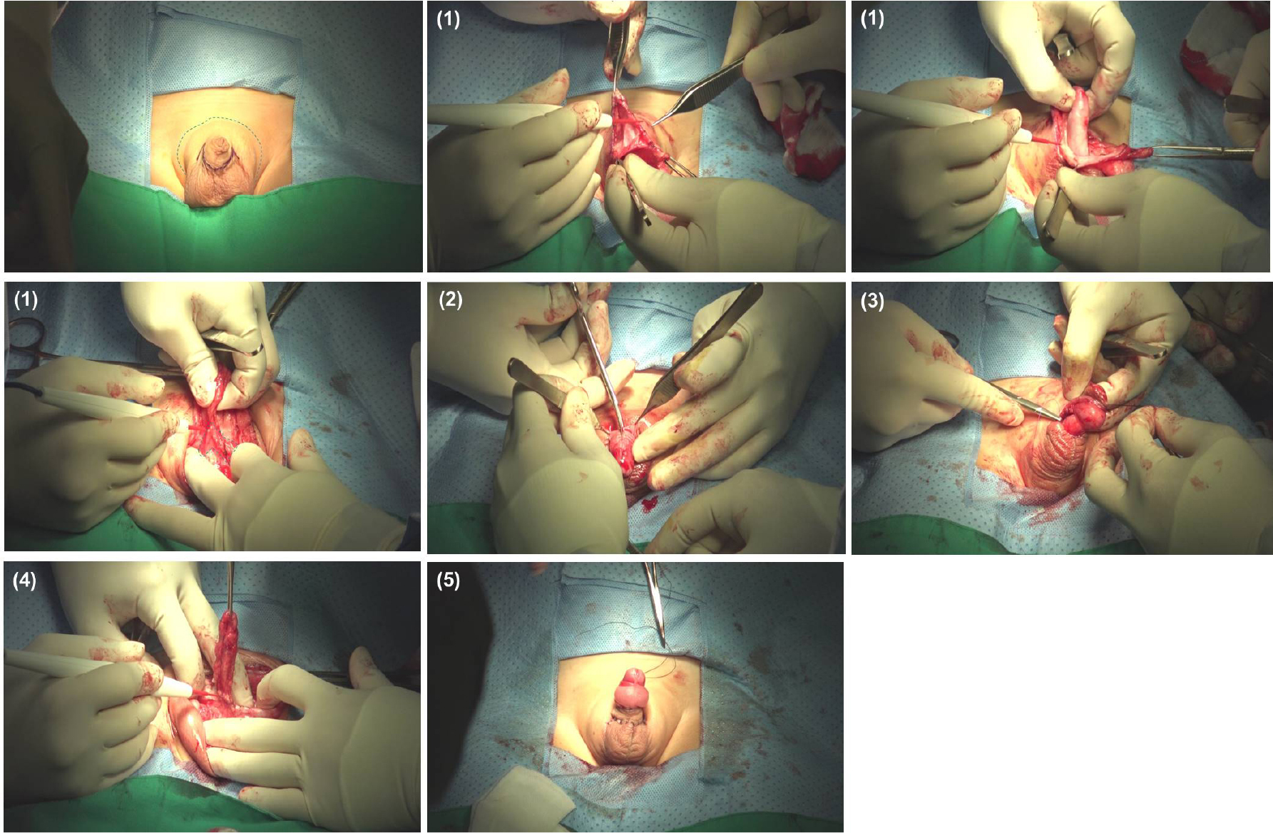 https://cdn.apub.kr/journalsite/sites/urology/2021-002-02/N0050020206/images/urology_02_02_06_F3.jpg
