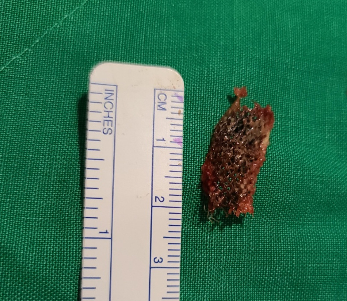 https://cdn.apub.kr/journalsite/sites/urology/2021-002-02/N0050020207/images/urology_02_02_07_F2.jpg