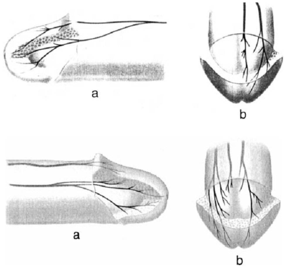 https://cdn.apub.kr/journalsite/sites/urology/2022-003-01/N0050030101/images/urology_03_01_01_F1.jpg