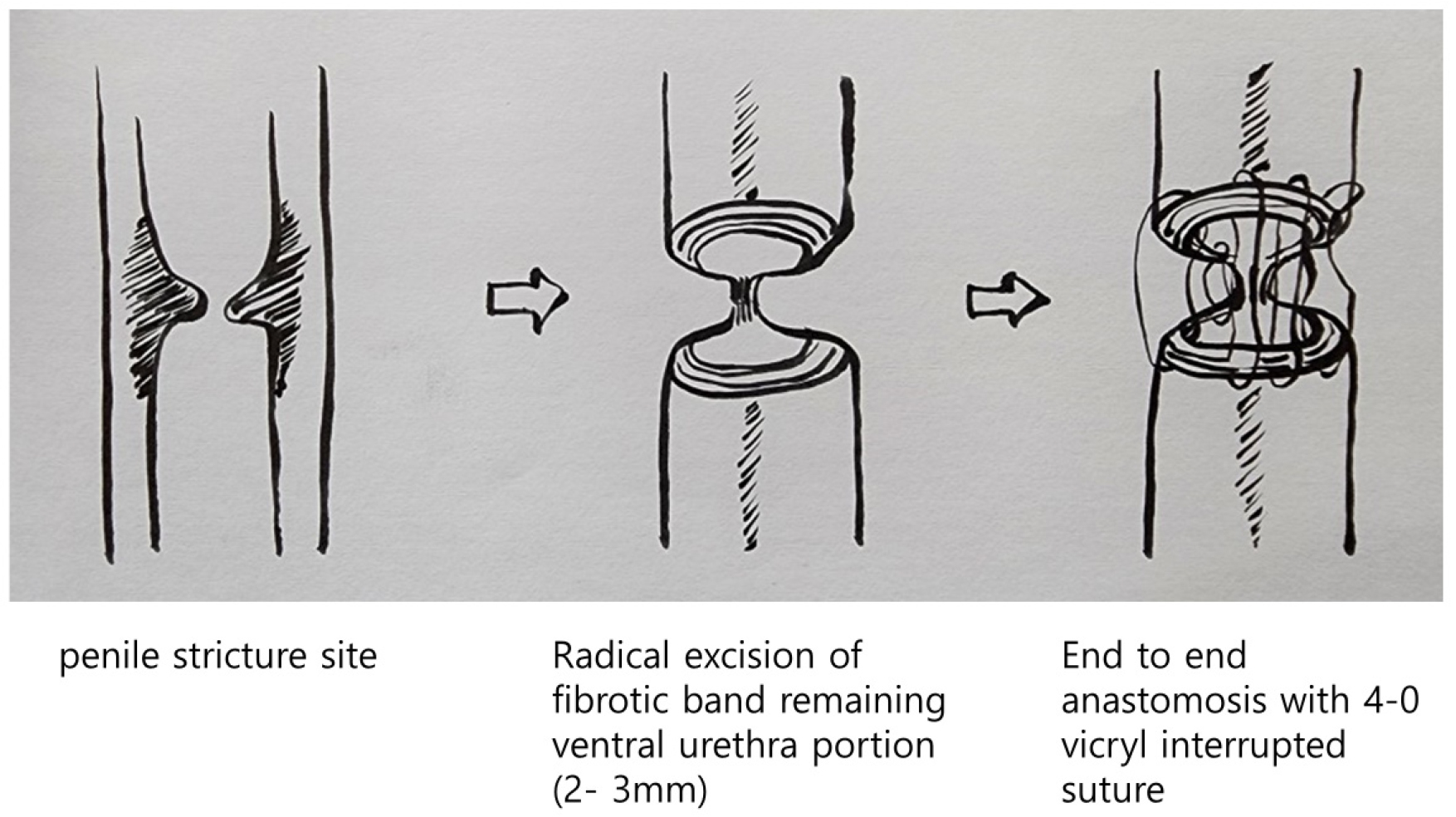 https://cdn.apub.kr/journalsite/sites/urology/2024-005-02/N0050050207/images/urology_05_02_07_F2.jpg