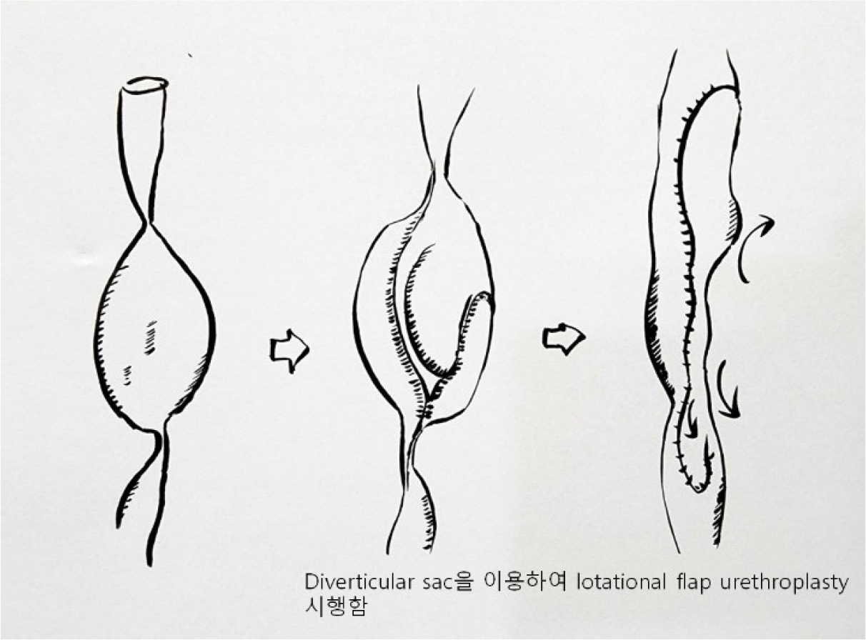 https://cdn.apub.kr/journalsite/sites/urology/2024-005-02/N0050050207/images/urology_05_02_07_F6.jpg