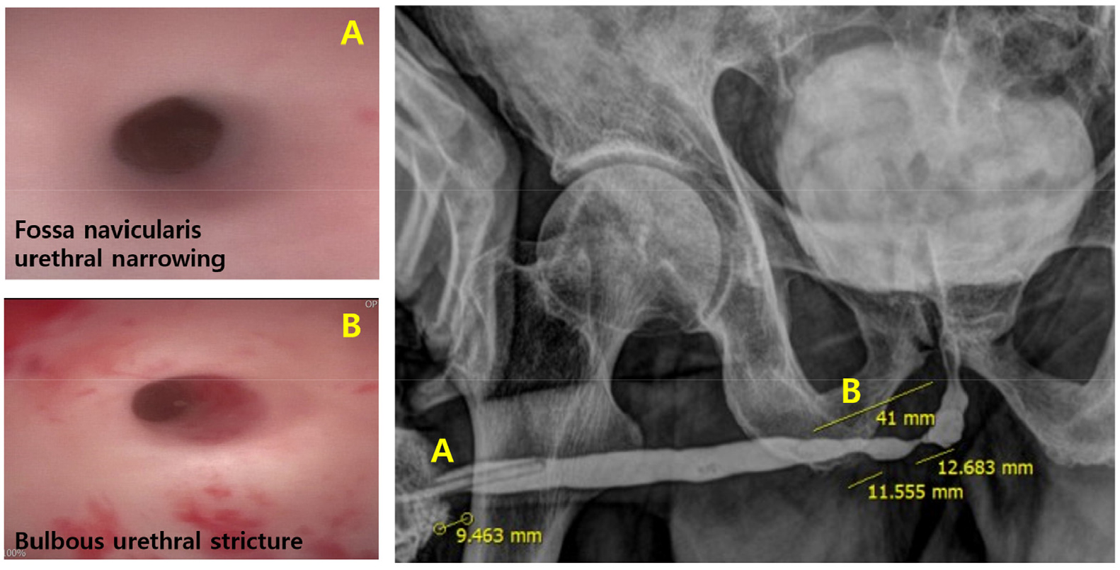 https://cdn.apub.kr/journalsite/sites/urology/2025-006-01/N0050060105/images/urology_06_01_05_F2.jpg