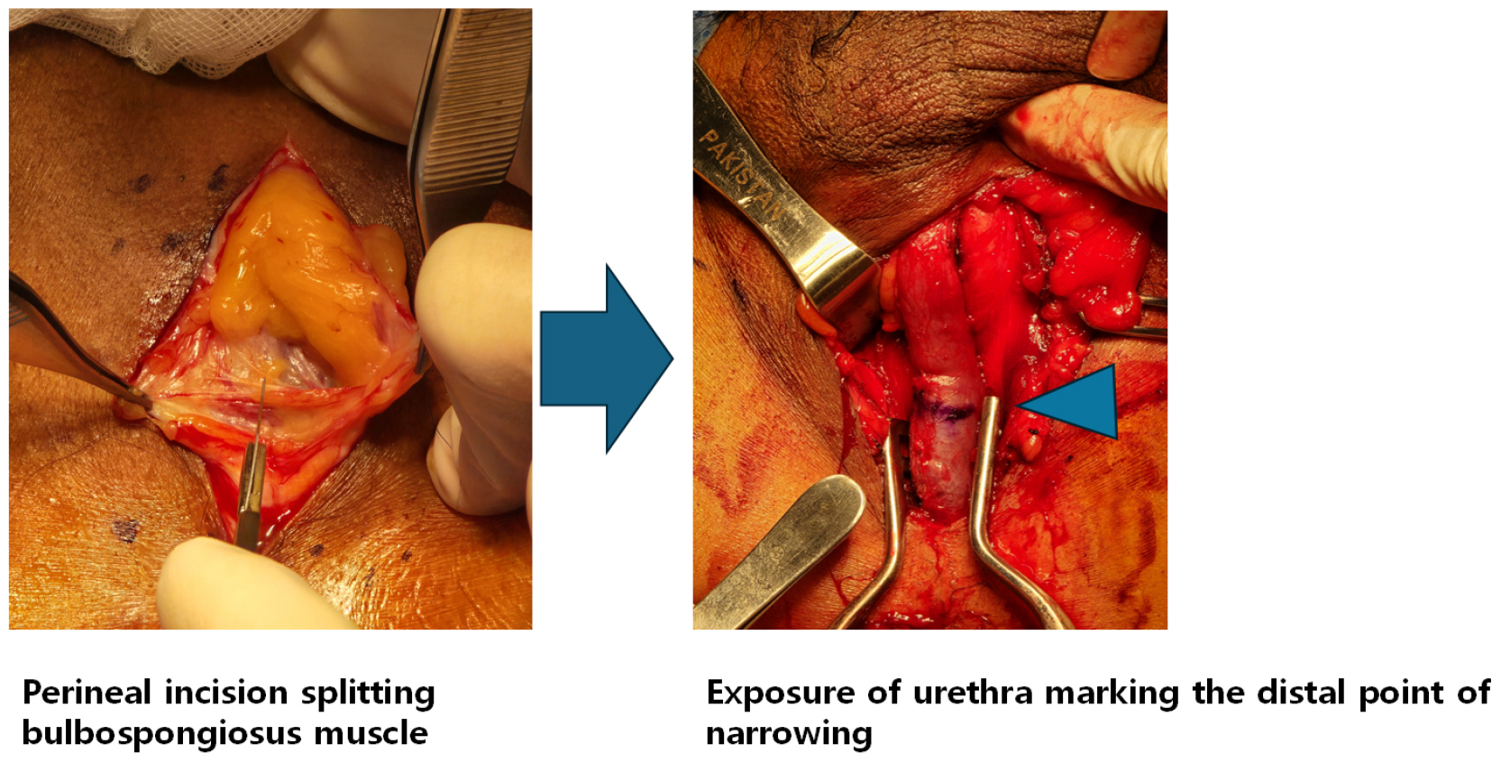 https://cdn.apub.kr/journalsite/sites/urology/2025-006-01/N0050060105/images/urology_06_01_05_F4.jpg