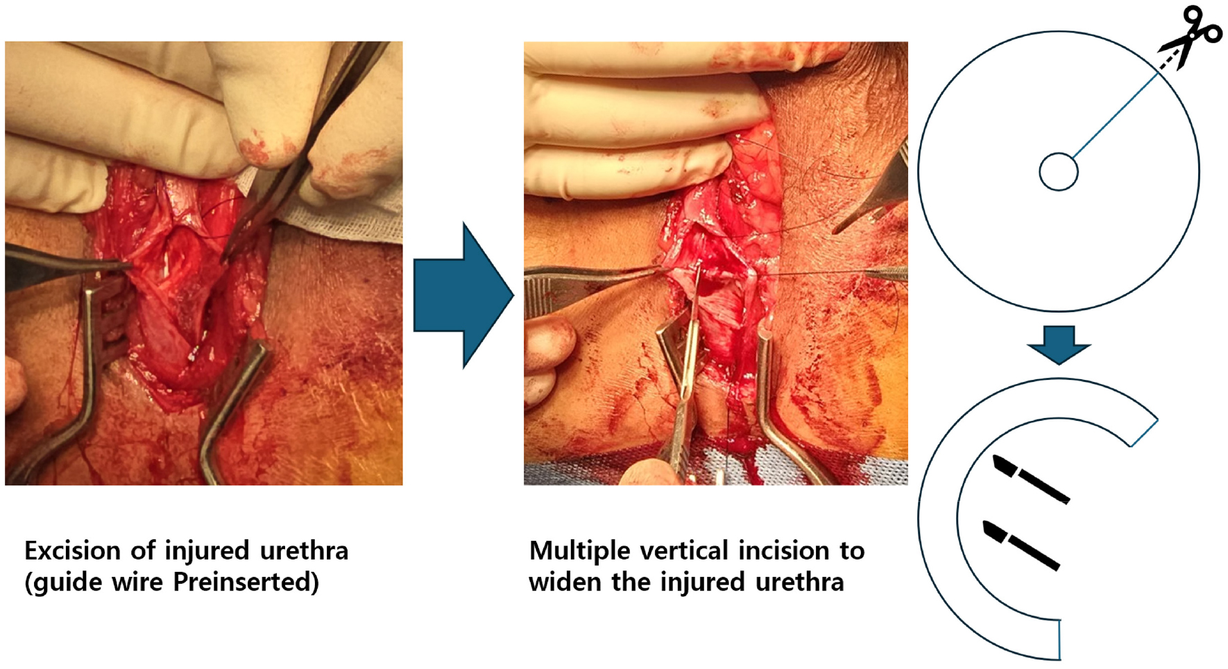 https://cdn.apub.kr/journalsite/sites/urology/2025-006-01/N0050060105/images/urology_06_01_05_F5.jpg