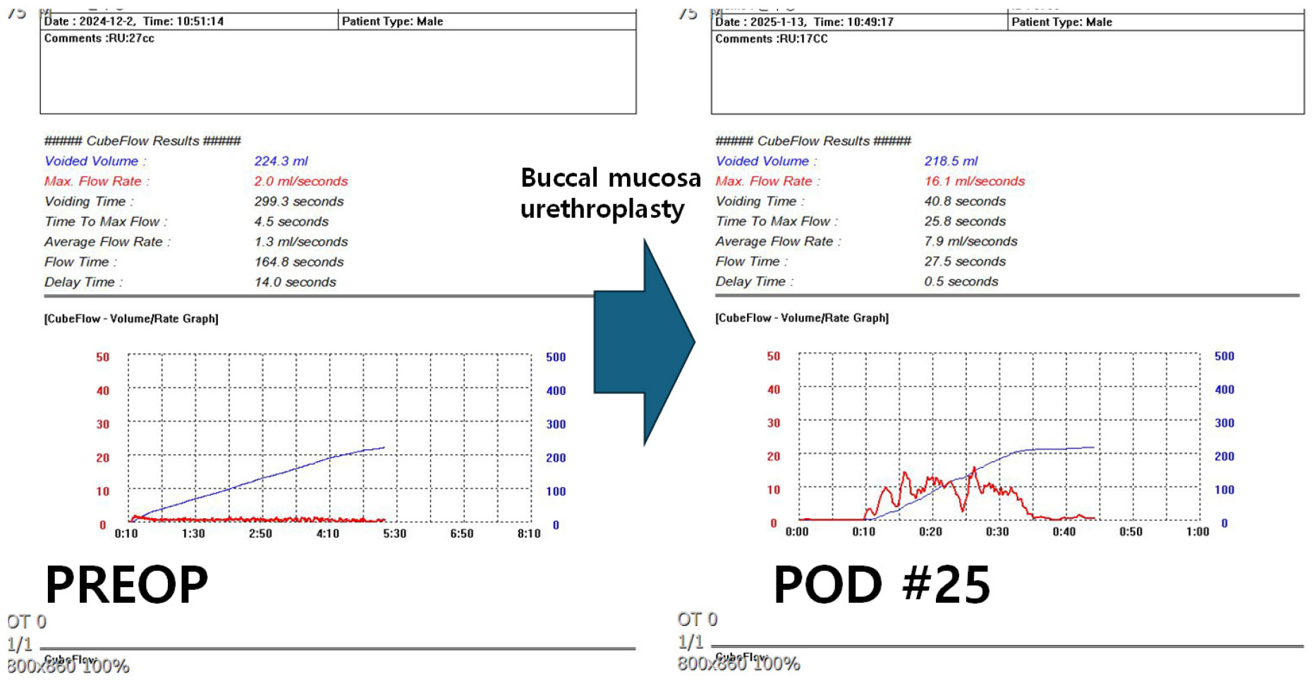 https://cdn.apub.kr/journalsite/sites/urology/2025-006-01/N0050060105/images/urology_06_01_05_F9.jpg