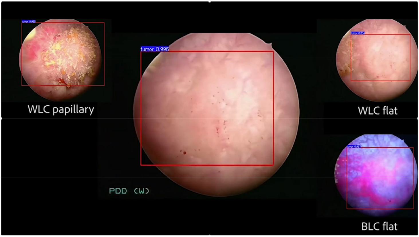 https://cdn.apub.kr/journalsite/sites/urology/2025-006-01/N0050060106/images/urology_06_01_06_F3.jpg